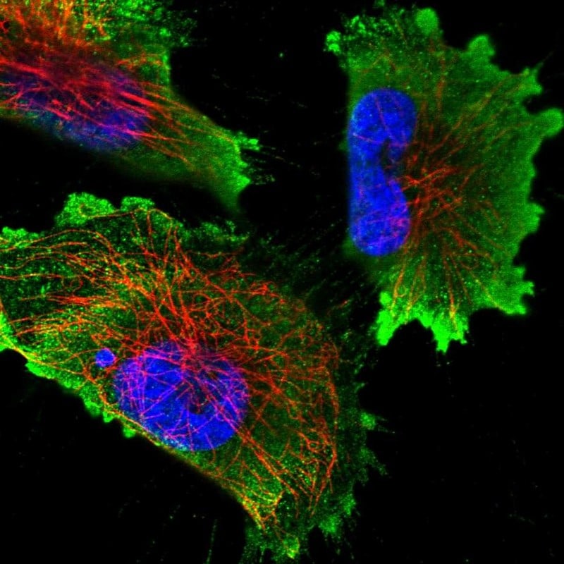 N6AMT2 Antibody - BSA Free Immunocytochemistry/ Immunofluorescence: N6AMT2 Antibody [NBP2-30940]