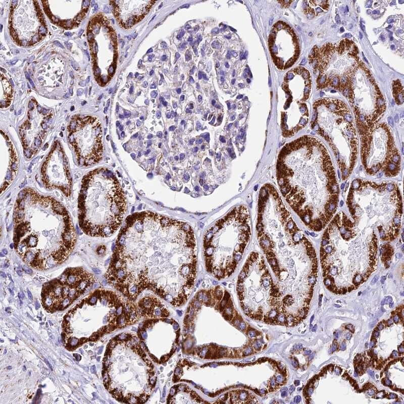 DCAF5 Antibody - BSA Free Immunohistochemistry-Paraffin: DCAF5 Antibody [NBP2-30998]