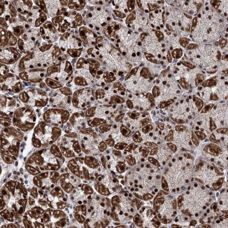 MORN3 Antibody - BSA Free Immunohistochemistry-Paraffin: MORN3 Antibody [NBP2-31007]