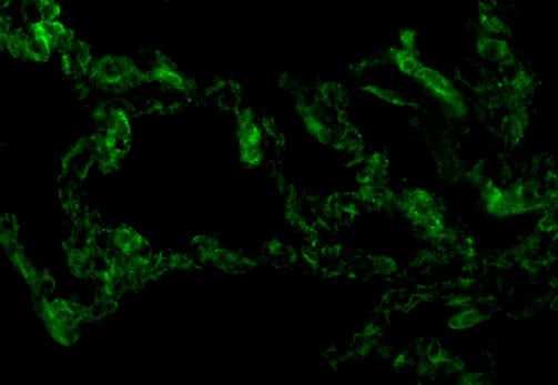 TRIF/TICAM1 Antibody - BSA Free