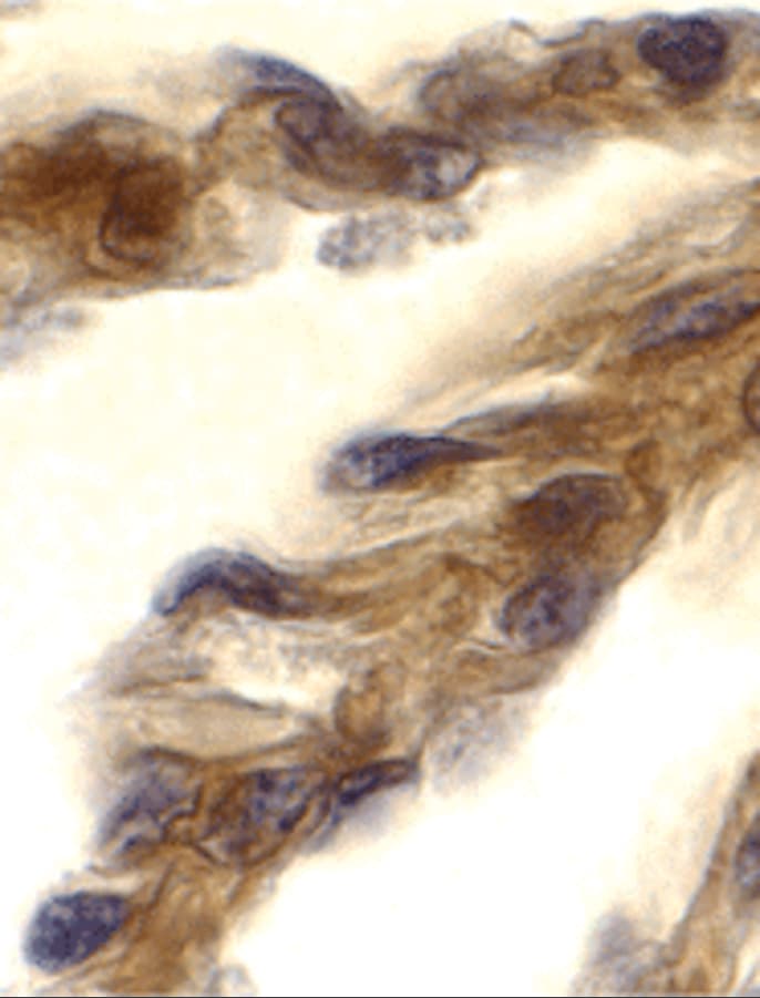 TRIF/TICAM1 Antibody - BSA Free