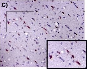 CCR5 Antibody