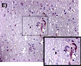 CCR5 Antibody