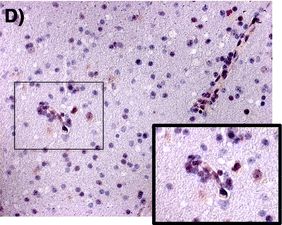 CCR5 Antibody
