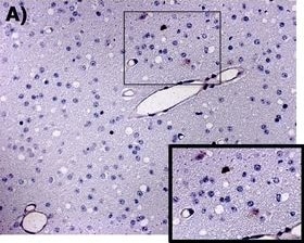 CCR5 Antibody