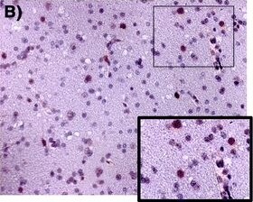 CCR5 Antibody