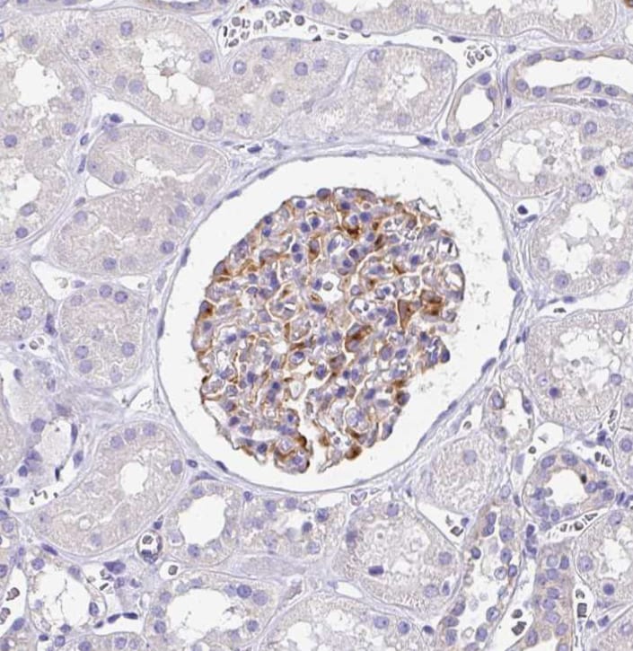 PPFIA4 Antibody - BSA Free