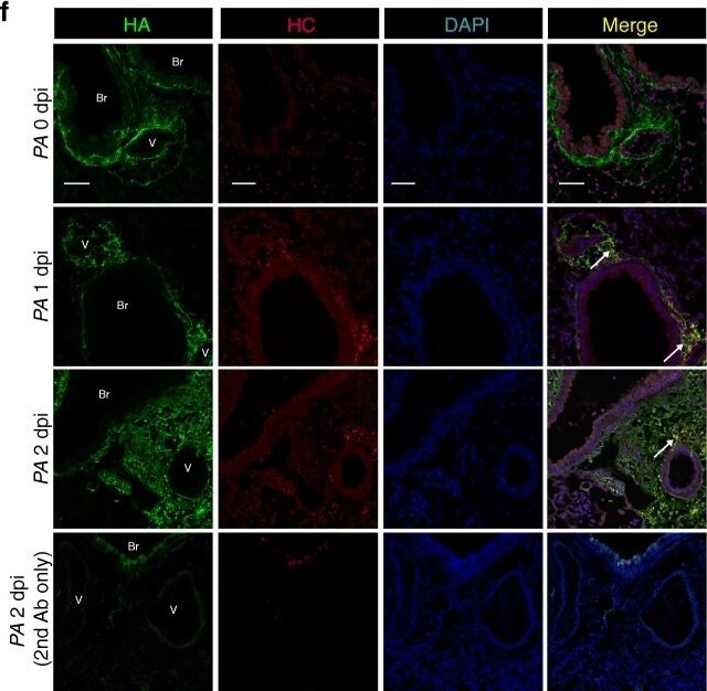ITIH2 Antibody - BSA Free