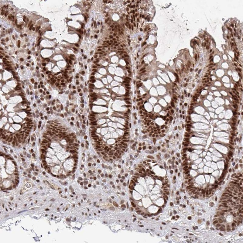 ZDHHC12 Antibody Immunohistochemistry-Paraffin: ZDHHC12 Antibody [NBP2-31763] -