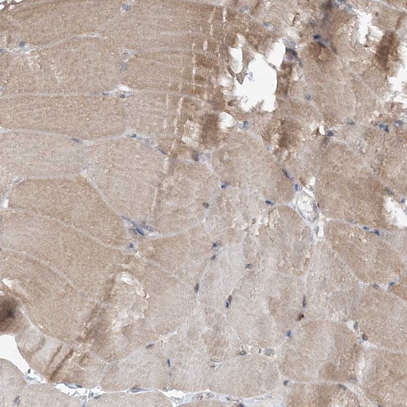 AAMDC Antibody - BSA Free Immunohistochemistry-Paraffin: AAMDC Antibody [NBP2-31969]