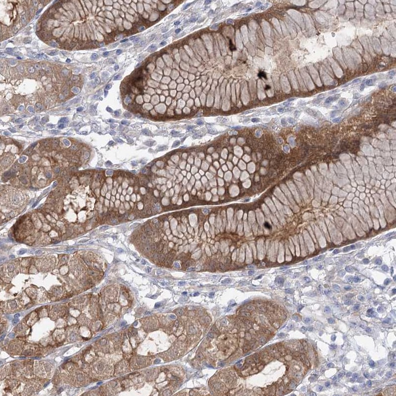 AAMDC Antibody - BSA Free Immunohistochemistry-Paraffin: AAMDC Antibody [NBP2-31969]