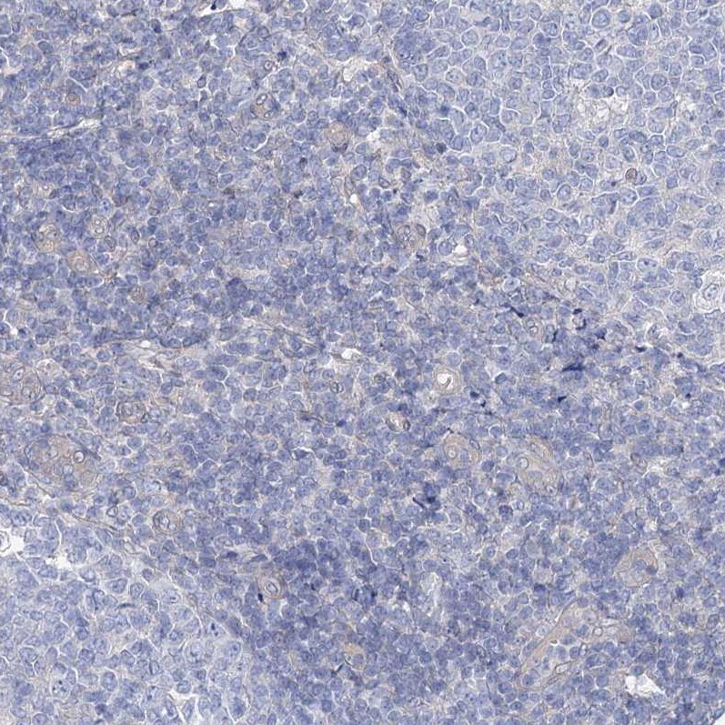 AAMDC Antibody - BSA Free Immunohistochemistry-Paraffin: AAMDC Antibody [NBP2-31969]