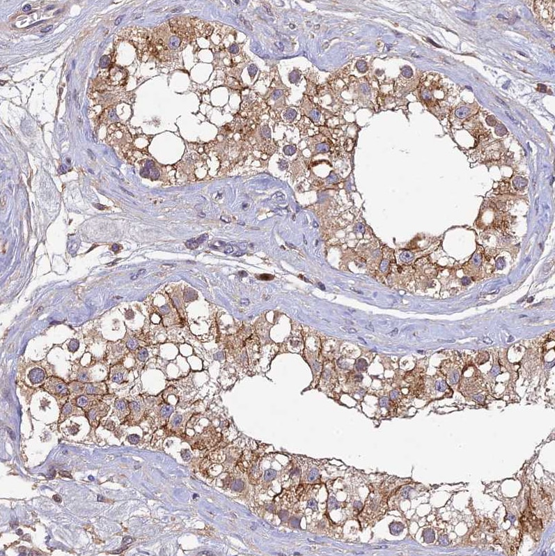 DENND5B Antibody - BSA Free Immunohistochemistry-Paraffin: DENND5B Antibody [NBP2-31971]