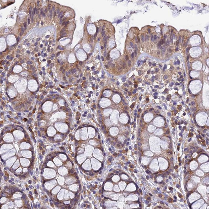 DENND5B Antibody - BSA Free Immunohistochemistry-Paraffin: DENND5B Antibody [NBP2-31971]