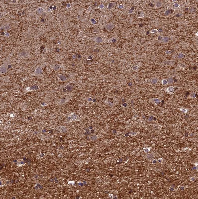 DENND5B Antibody - BSA Free Immunohistochemistry-Paraffin: DENND5B Antibody [NBP2-31971]