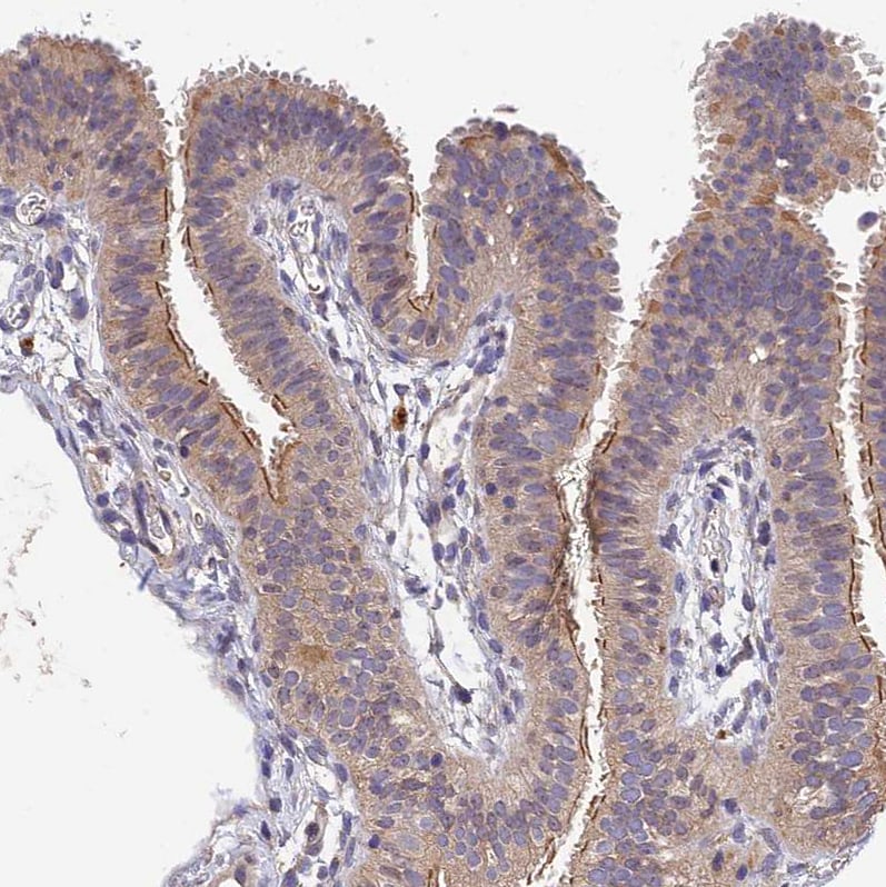 DENND5B Antibody - BSA Free Immunohistochemistry-Paraffin: DENND5B Antibody [NBP2-31971]