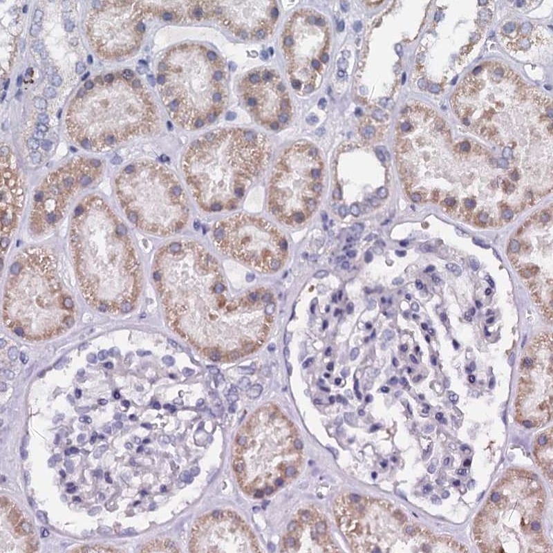 SLC37A4 Antibody - BSA Free Immunohistochemistry: SLC37A4 Antibody - BSA Free [NBP2-31973]
