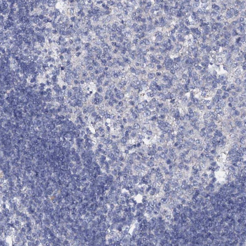 SLC37A4 Antibody - BSA Free Immunohistochemistry: SLC37A4 Antibody - BSA Free [NBP2-31973]