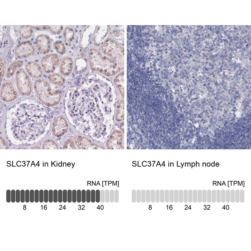 SLC37A4 Antibody - BSA Free Immunohistochemistry: SLC37A4 Antibody - BSA Free [NBP2-31973]