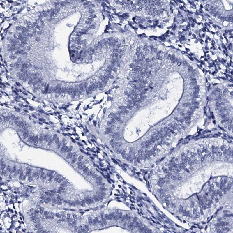 SPATA19 Antibody - BSA Free Immunohistochemistry: SPATA19 Antibody - BSA Free [NBP2-31979]