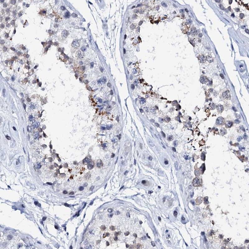 SPATA19 Antibody - BSA Free Immunohistochemistry: SPATA19 Antibody - BSA Free [NBP2-31979]