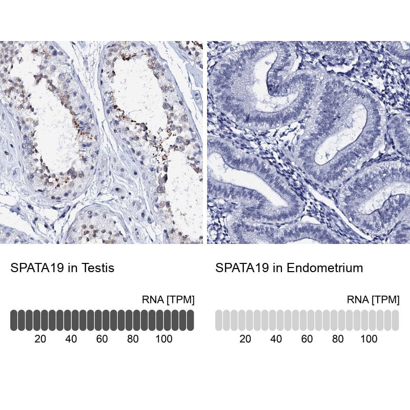 SPATA19 Antibody - BSA Free Immunohistochemistry: SPATA19 Antibody - BSA Free [NBP2-31979]