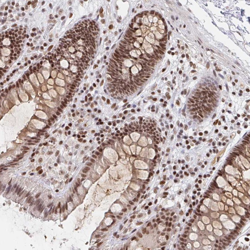 H1FX Antibody - BSA Free Immunohistochemistry-Paraffin: H1FX Antibody [NBP2-31980]