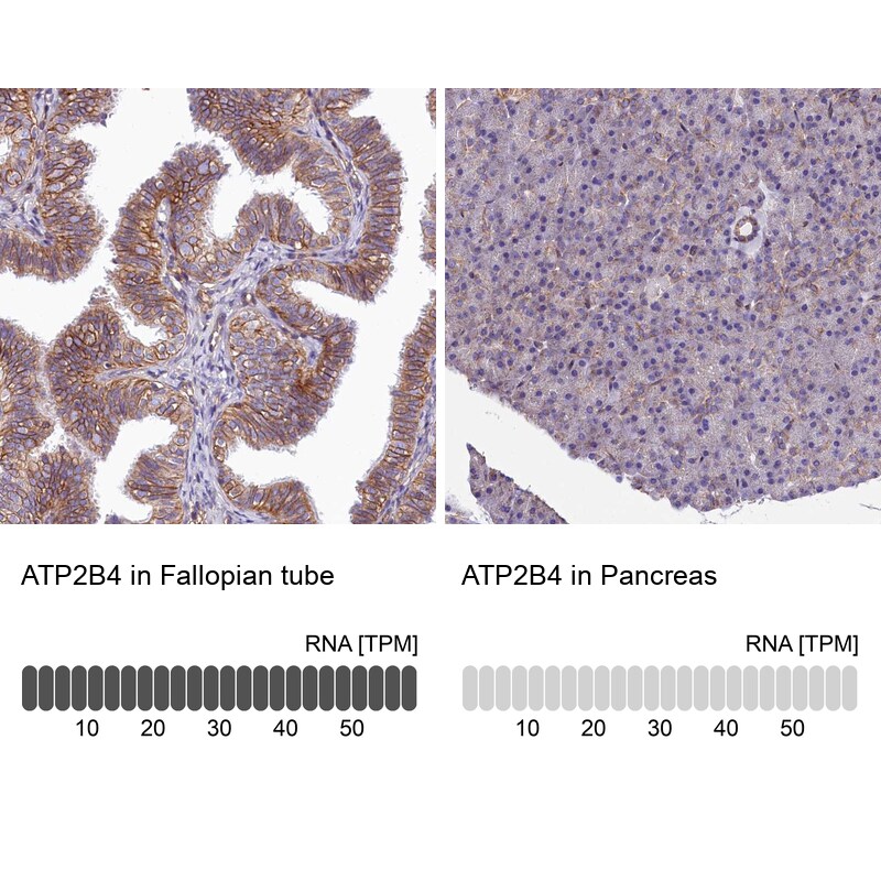 PMCA4 Antibody - BSA Free Immunohistochemistry-Paraffin: PMCA4 Antibody [NBP2-31984]