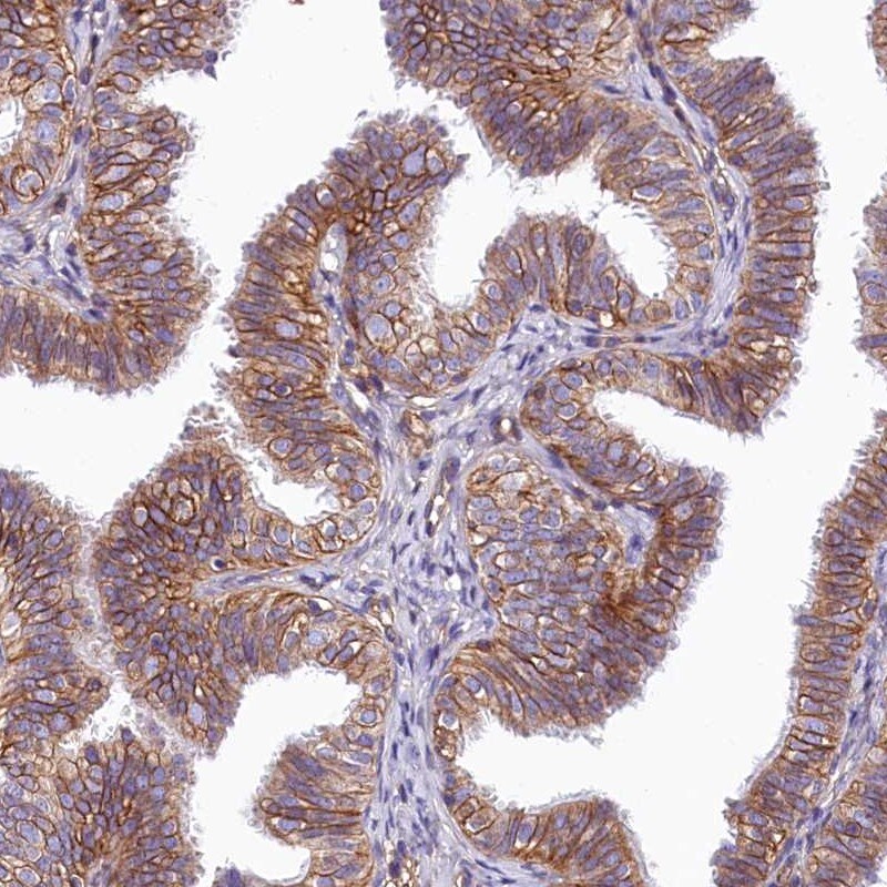 PMCA4 Antibody - BSA Free Immunohistochemistry-Paraffin: PMCA4 Antibody [NBP2-31984]