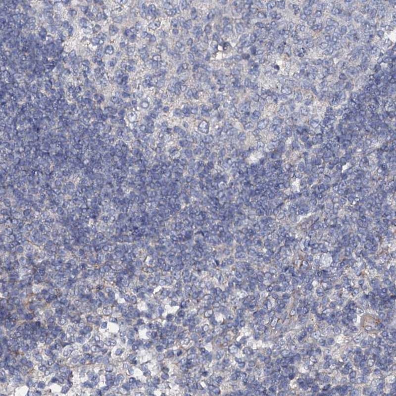 Glucuronic Acid Epimerase Antibody - BSA Free Immunohistochemistry-Paraffin: Glucuronic Acid Epimerase Antibody [NBP2-31985]