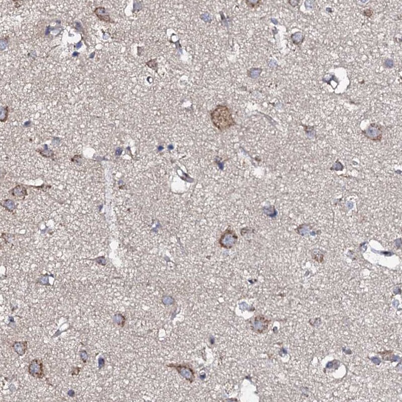 Glucuronic Acid Epimerase Antibody - BSA Free Immunohistochemistry-Paraffin: Glucuronic Acid Epimerase Antibody [NBP2-31985]
