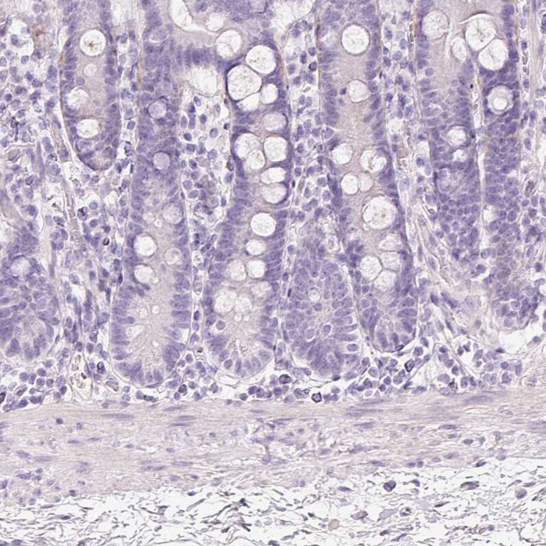 MUC5AC Antibody - BSA Free Immunohistochemistry-Paraffin: MUC5AC Antibody [NBP2-31986]