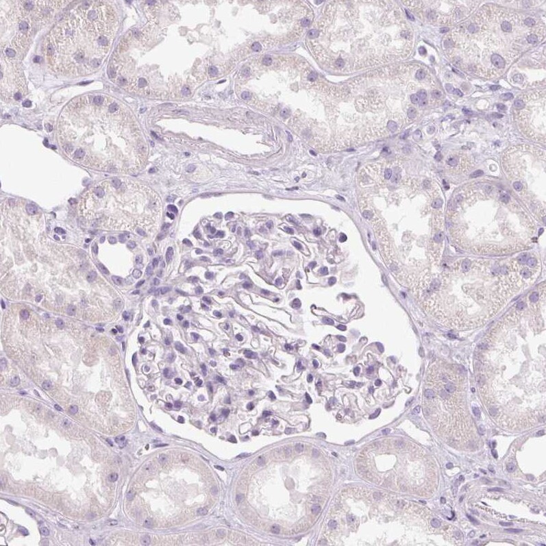 MUC5AC Antibody - BSA Free Immunohistochemistry-Paraffin: MUC5AC Antibody [NBP2-31986]