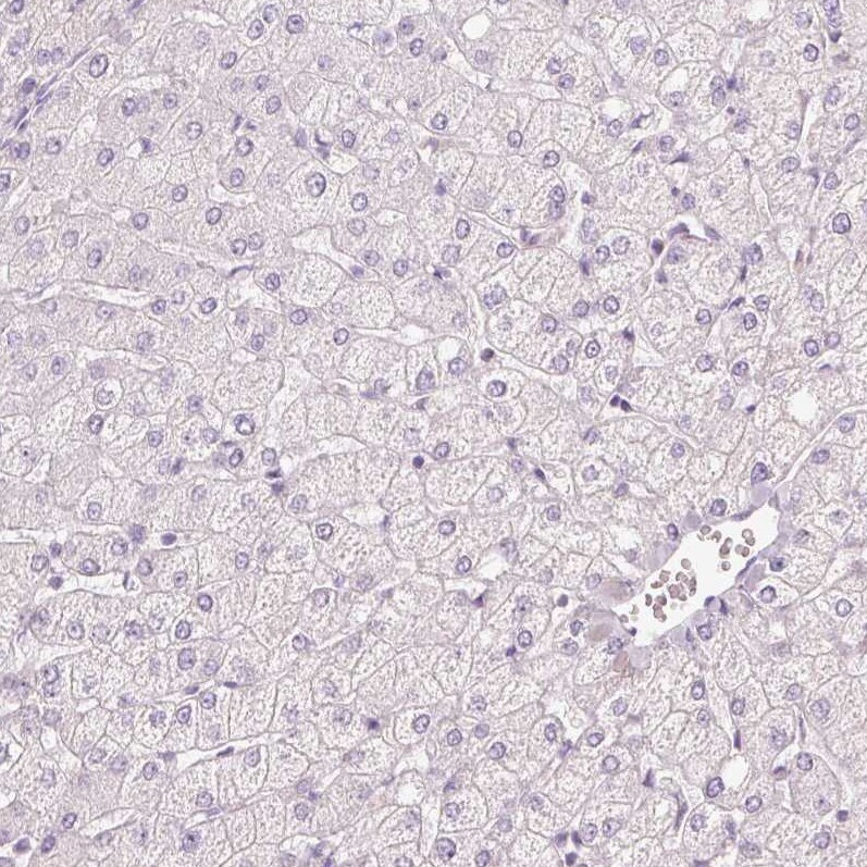 MUC5AC Antibody - BSA Free Immunohistochemistry-Paraffin: MUC5AC Antibody [NBP2-31986]