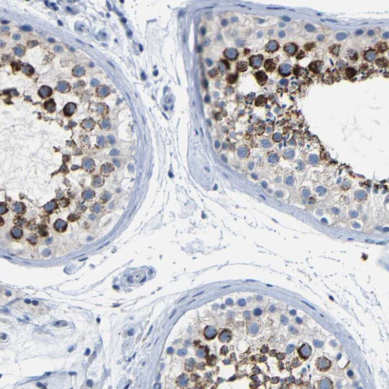 NMES1 Antibody Immunohistochemistry-Paraffin: NMES1 Antibody [NBP2-31996]