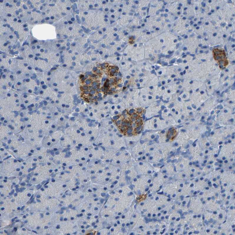 NMES1 Antibody Immunohistochemistry-Paraffin: TCL1A Antibody [NBP2-31996]