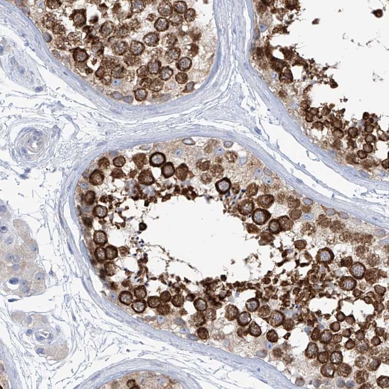 RCN2 Antibody - BSA Free Immunohistochemistry-Paraffin: RCN2 Antibody [NBP2-32010]