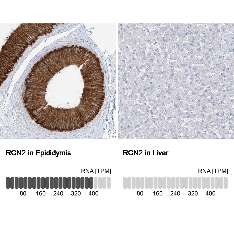 RCN2 Antibody - BSA Free Immunohistochemistry-Paraffin: RCN2 Antibody [NBP2-32010]