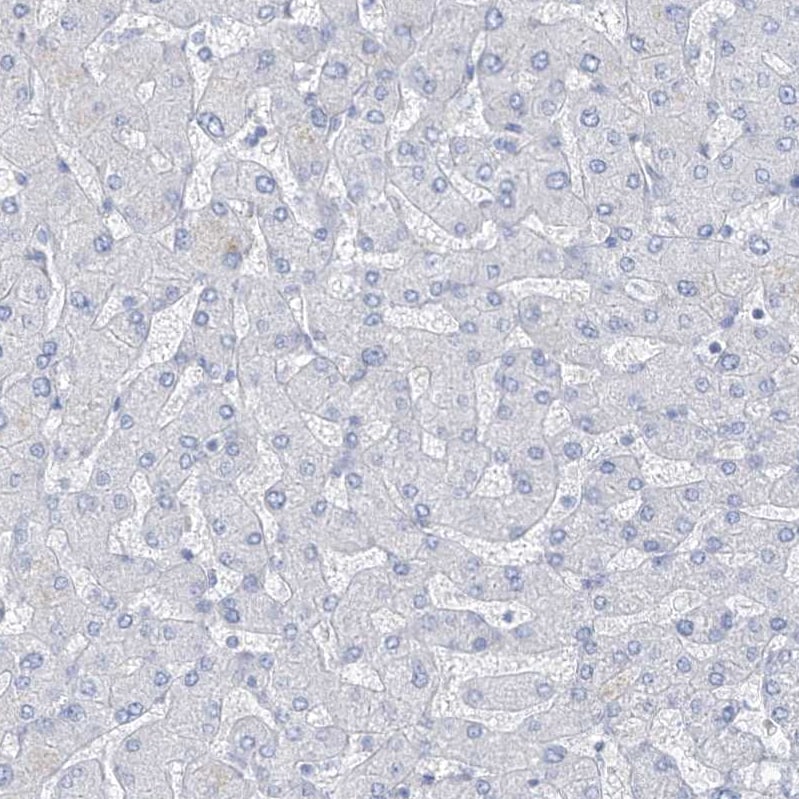 RCN2 Antibody - BSA Free Immunohistochemistry-Paraffin: RCN2 Antibody [NBP2-32010]