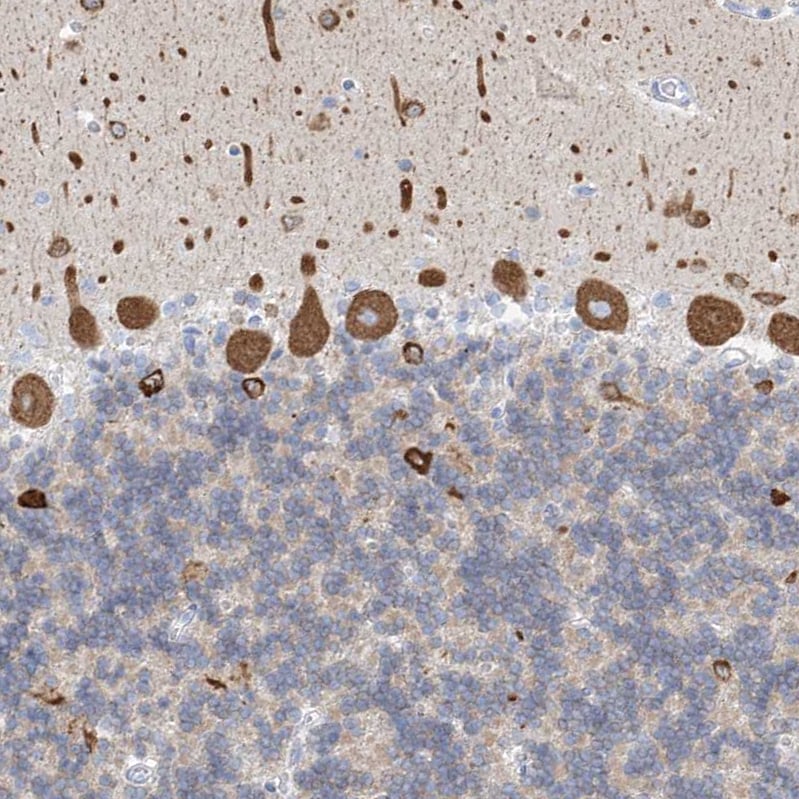 RCN2 Antibody - BSA Free Immunohistochemistry-Paraffin: RCN2 Antibody [NBP2-32010]
