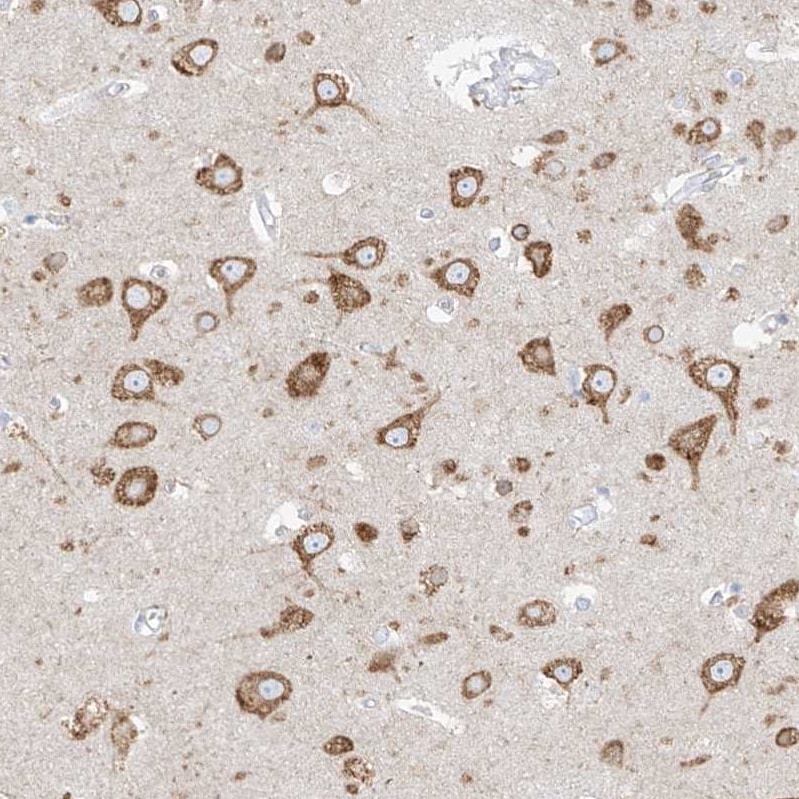RCN2 Antibody - BSA Free Immunohistochemistry-Paraffin: RCN2 Antibody [NBP2-32010]