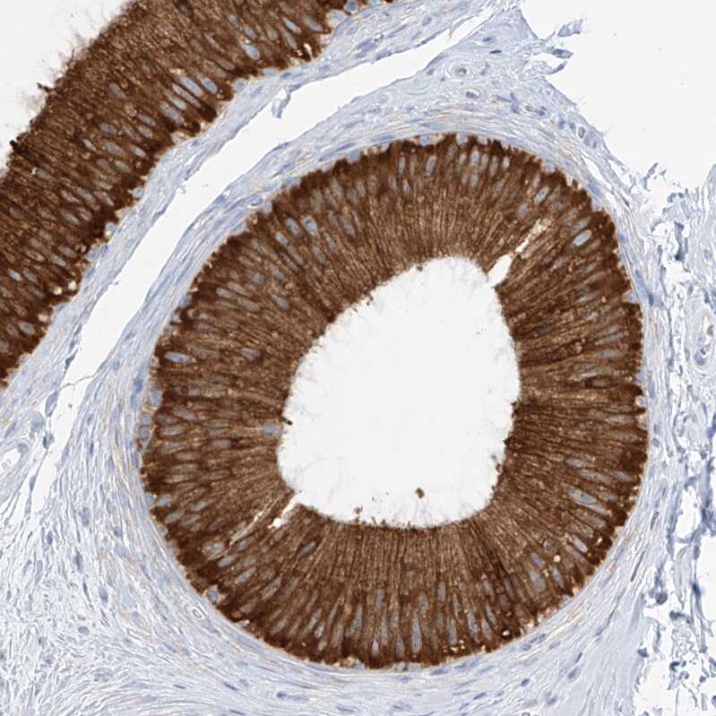 RCN2 Antibody - BSA Free Immunohistochemistry-Paraffin: RCN2 Antibody [NBP2-32010]
