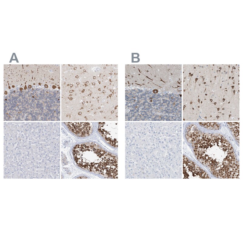 RCN2 Antibody - BSA Free Immunohistochemistry-Paraffin: RCN2 Antibody [NBP2-32010]