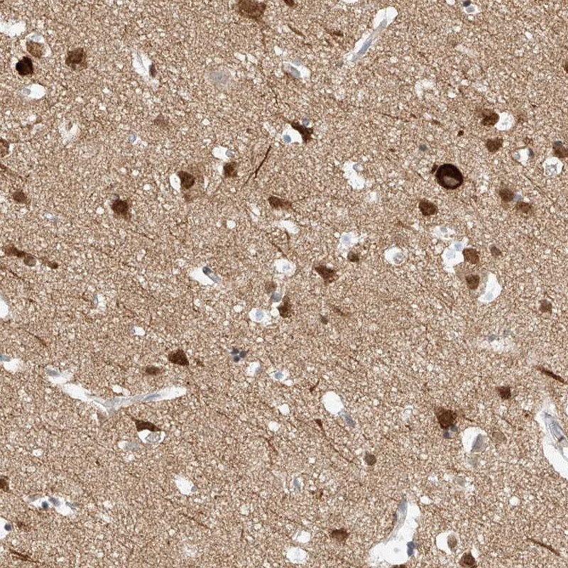 REEP2 Antibody - BSA Free Immunohistochemistry: REEP2 Antibody - BSA Free [NBP2-32017]