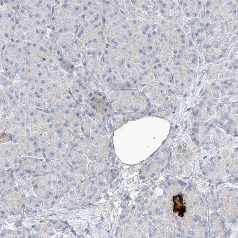 REEP2 Antibody - BSA Free Immunohistochemistry: REEP2 Antibody - BSA Free [NBP2-32017]