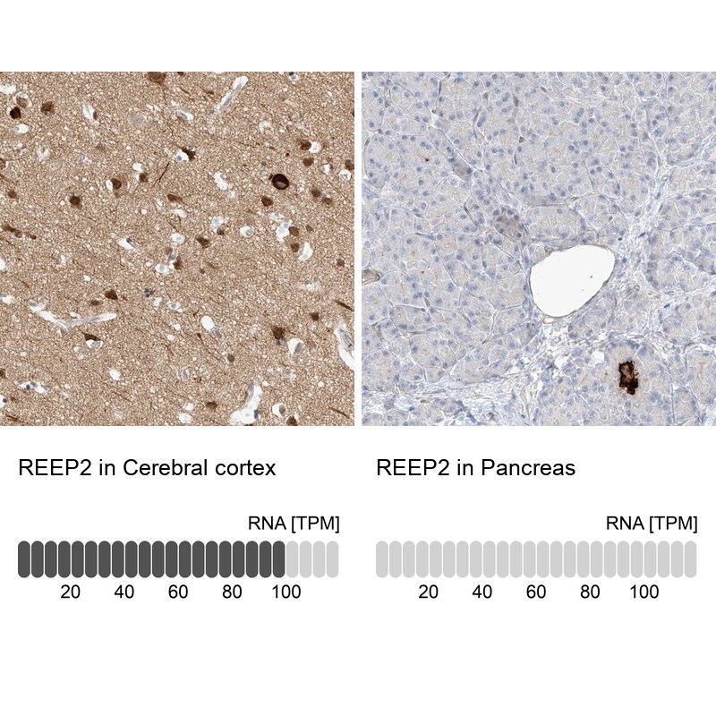 REEP2 Antibody - BSA Free Immunohistochemistry: REEP2 Antibody - BSA Free [NBP2-32017]