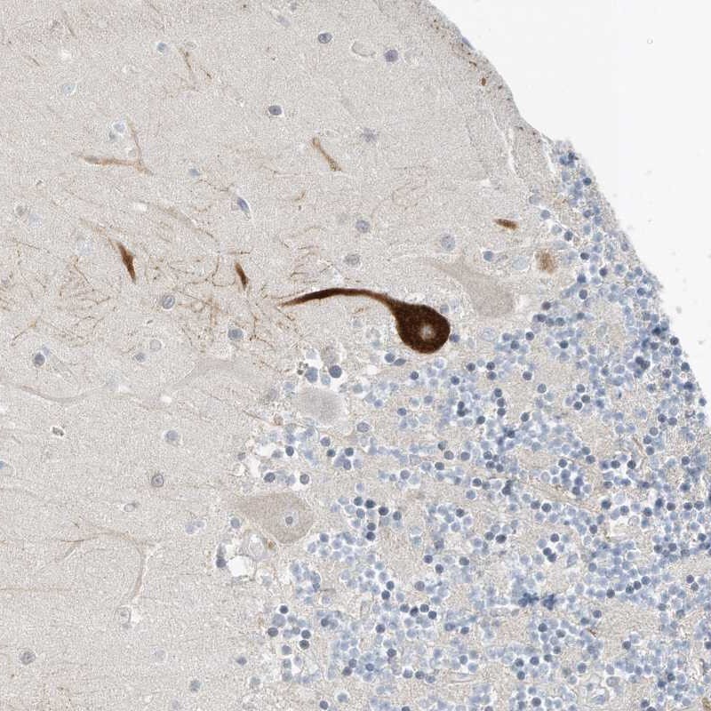 GAP1m Antibody - BSA Free Immunohistochemistry: GAP1m Antibody - BSA Free [NBP2-32019]