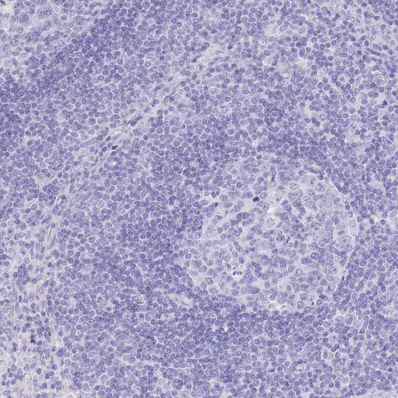 SLC4A4 Antibody - BSA Free Immunohistochemistry-Paraffin: SLC4A4 Antibody [NBP2-32020]