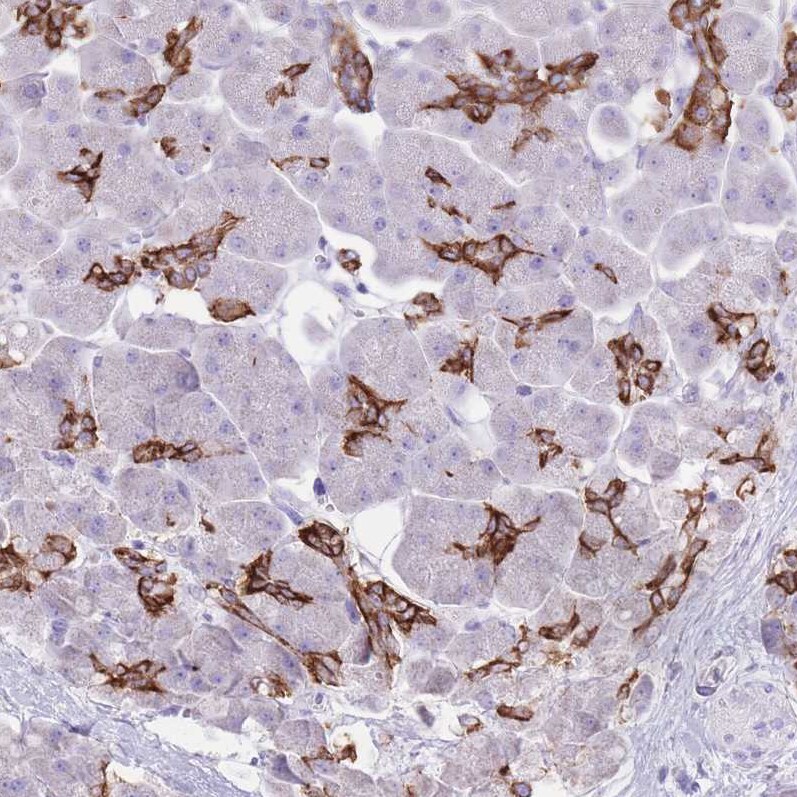 SLC4A4 Antibody - BSA Free Immunohistochemistry-Paraffin: SLC4A4 Antibody [NBP2-32020]