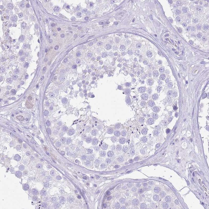 SLC4A4 Antibody - BSA Free Immunohistochemistry-Paraffin: SLC4A4 Antibody [NBP2-32020]